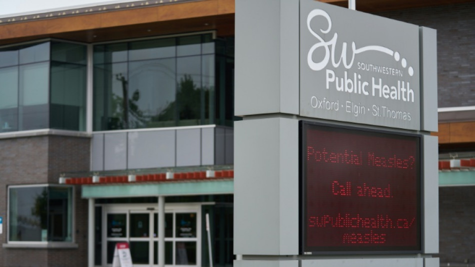 Canad&aacute; pierde el estatus de pa&iacute;s libre de sarampi&oacute;n