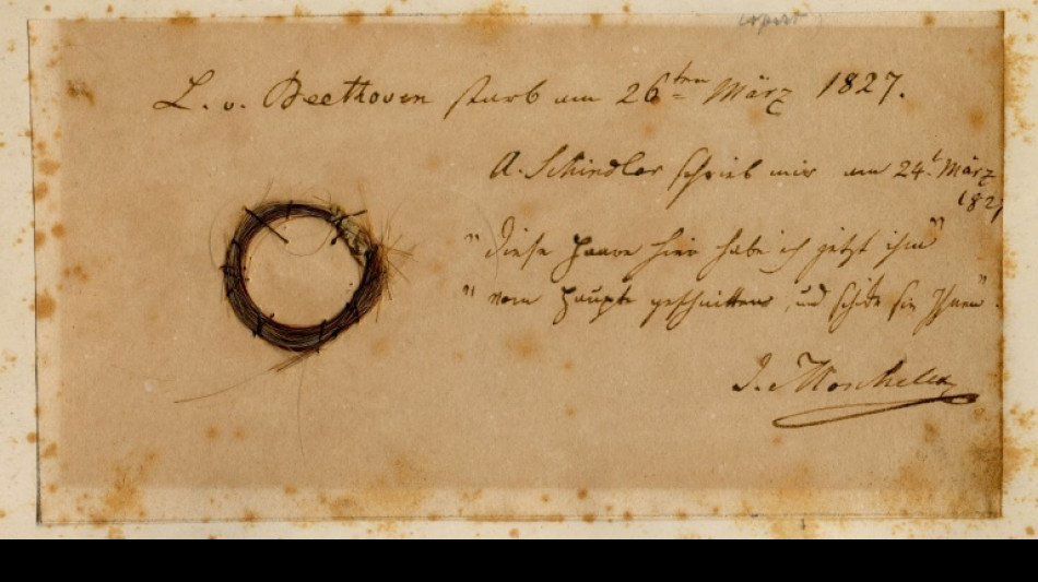 La mort de Beethoven à la lumière de son ADN