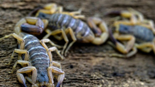 De la vive à la punaise de lit, ces "bestioles" qui irritent les urgences