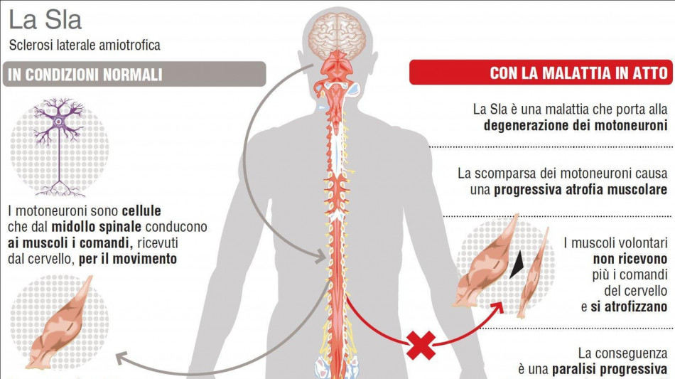 Ricerca sulla Sla, da un recettore la strategia per proteggere i motoneuroni